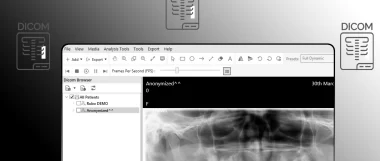 How to Open DICOM File on Windows PC?