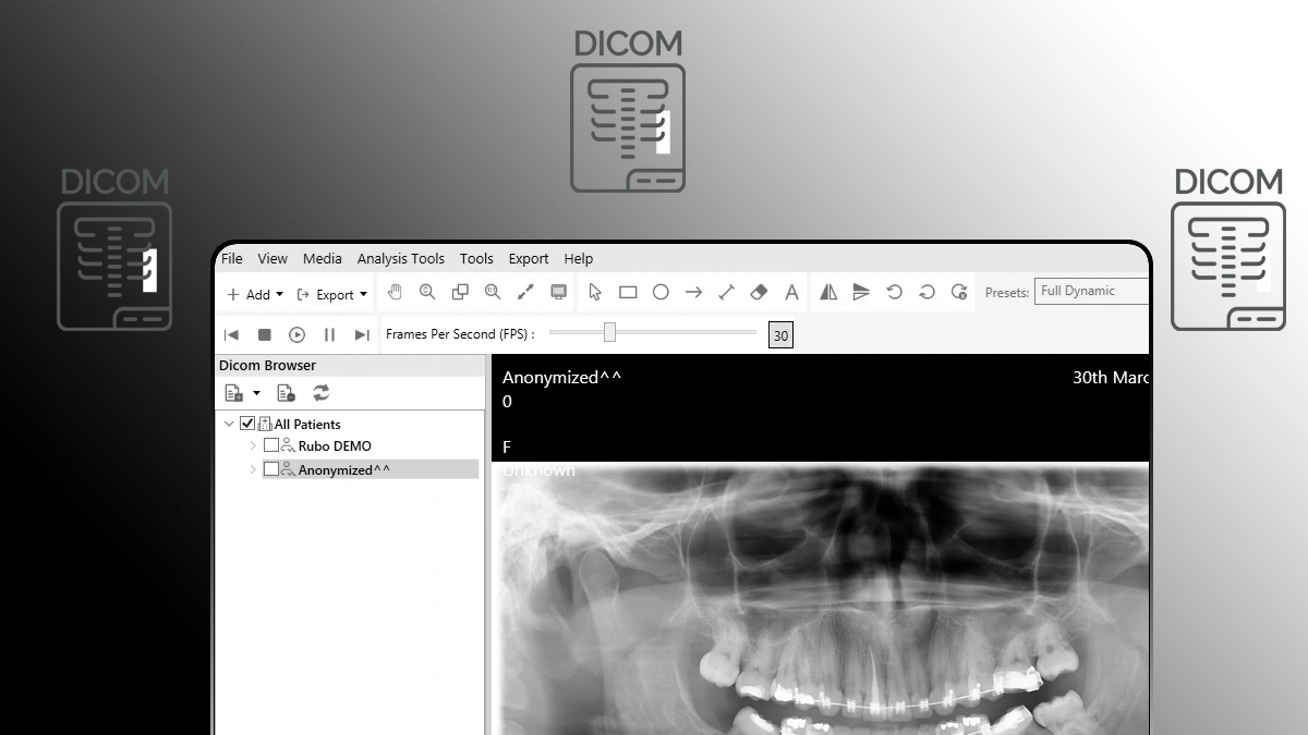 How to Open DICOM File on Windows PC?