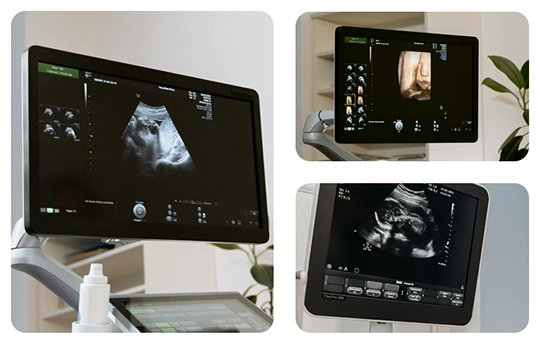 Multi image Review on Windows OS