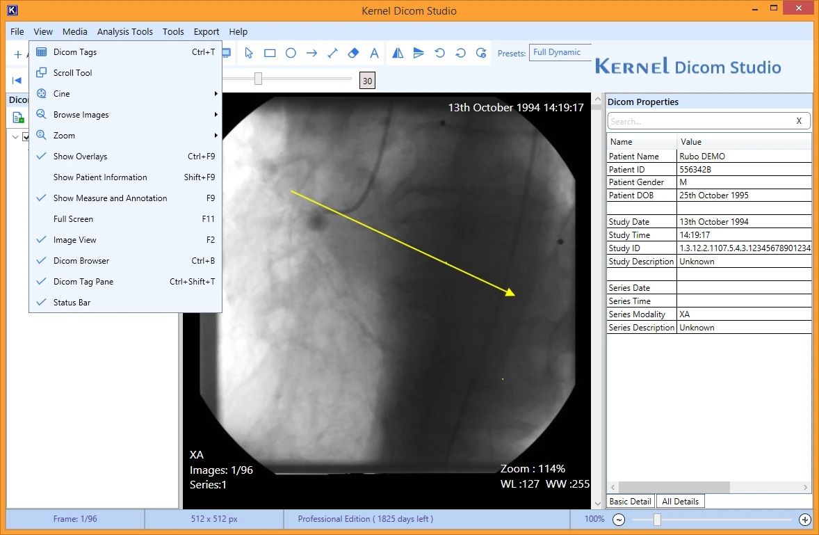 Allows a bigger preview of the selected DICOM file