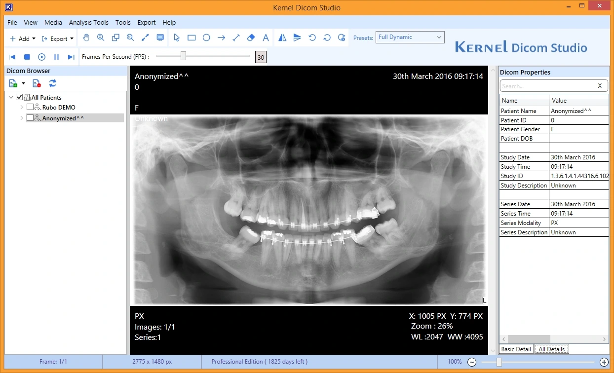 Check out the properties of the added Dicom file