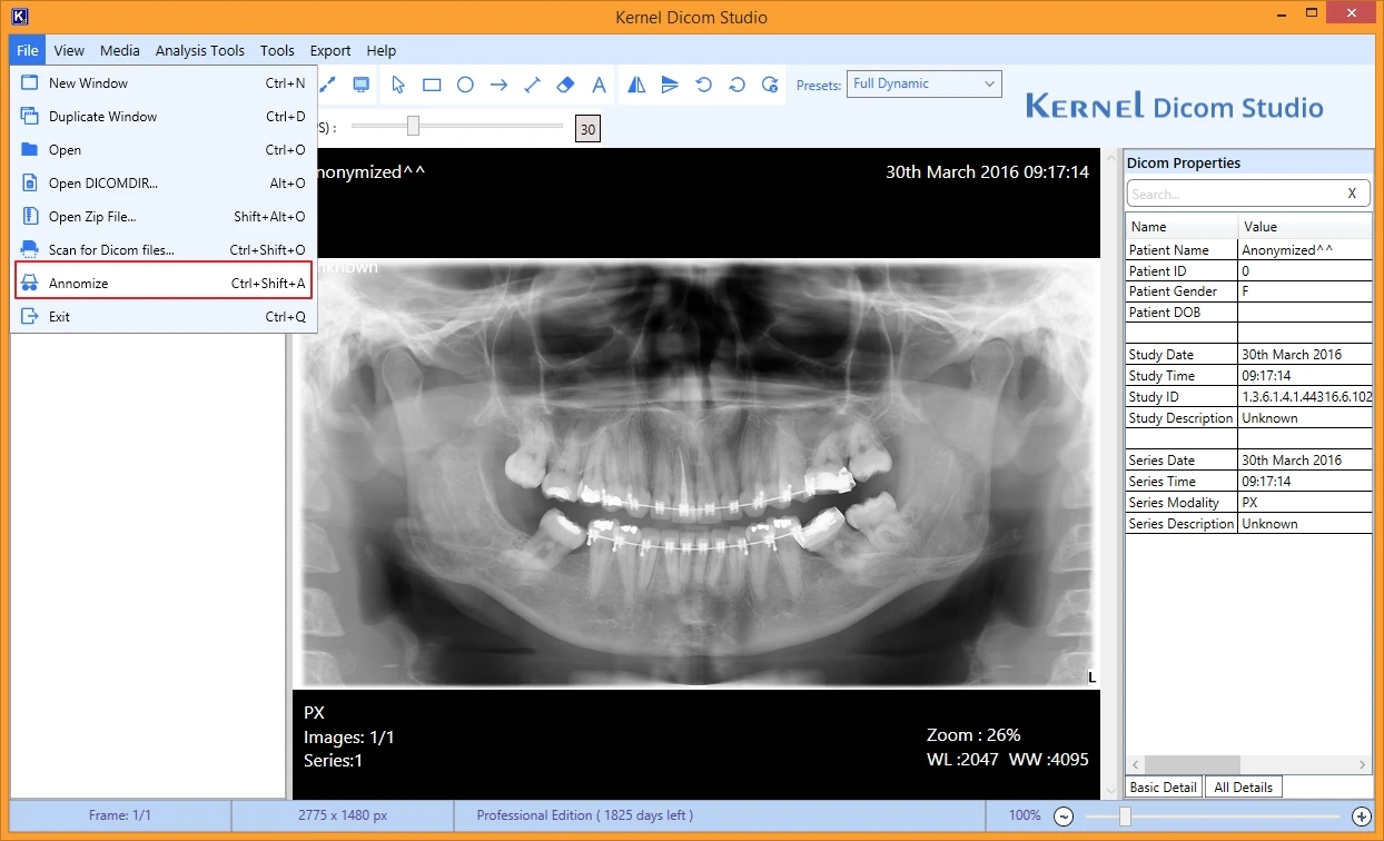 Make the image anonymous and hide the patient details