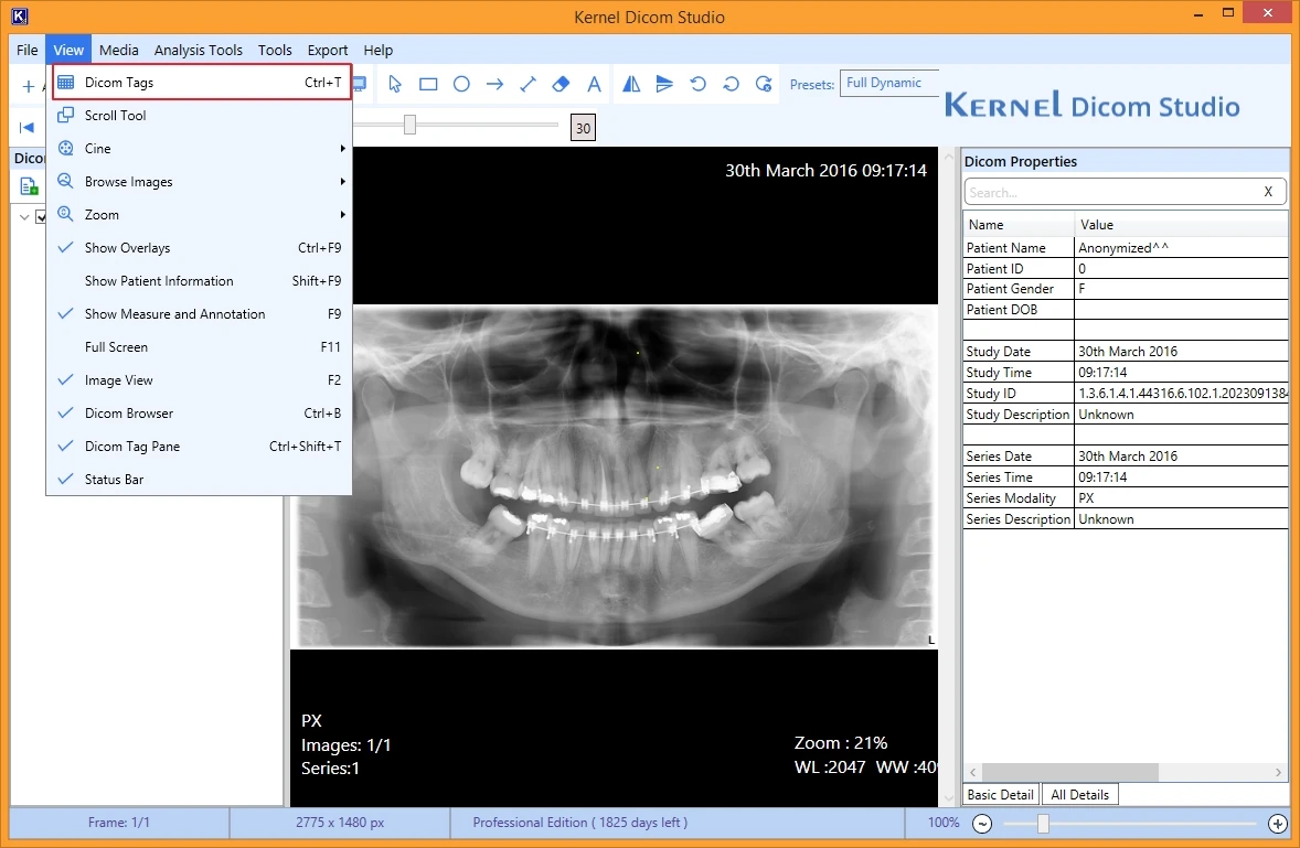 view Dicom Tags associated to the selected Dicom file